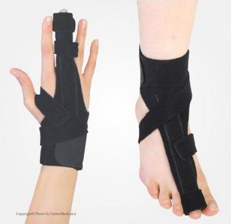 اتل دست و پا ضد حساسیت